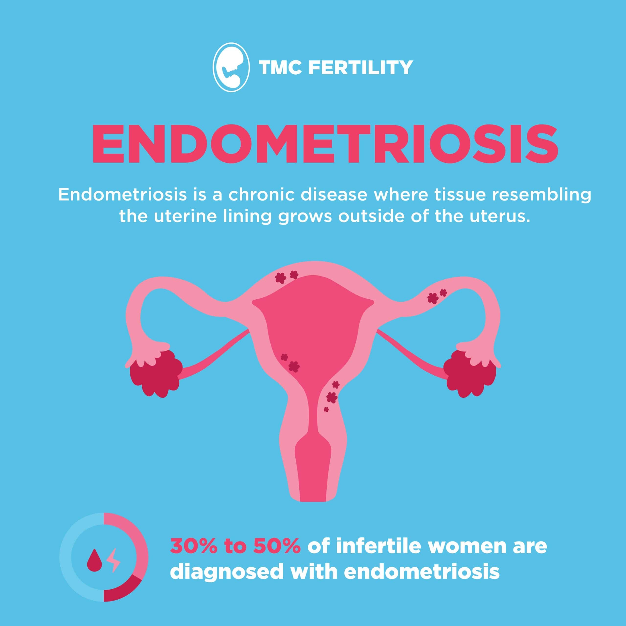 Unveiling the Mystery of Endometriosis Towards Hope and Empowerment